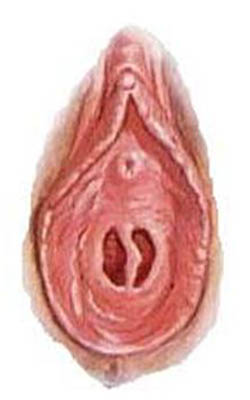 Hymen septatus