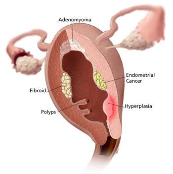 endometrium